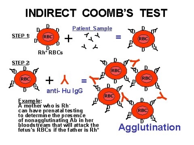 Indirect Coomb's Test diagram