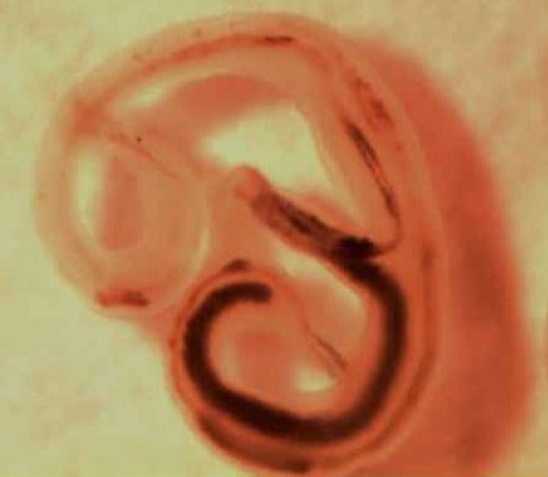 Scientists sneak peek at early course of bladder infection caused by widespread, understudied parasite