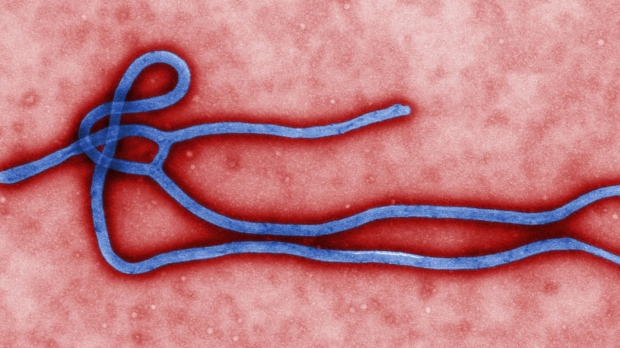 Seed grants available for Ebola-related projects
