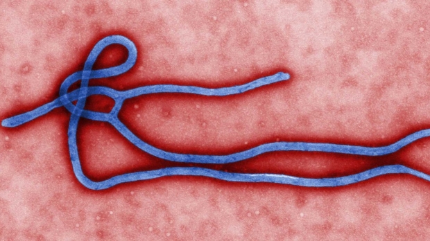 Seed grants aim to jump-start Ebola research