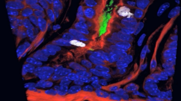 Ulcer-causing bacteria induces stomach stem cell growth in mice, researchers find