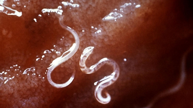Large-scale treatment of parasitic-worm disease cost-effective, Stanford-led study shows