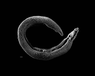 black intestinal worms