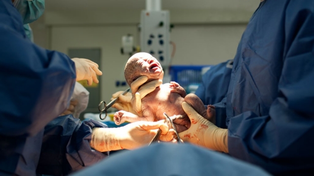 Optimal C-section rate