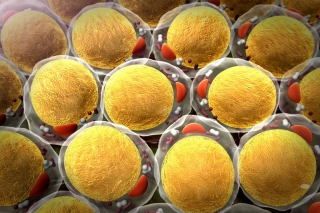 3-D rendering of fat cells