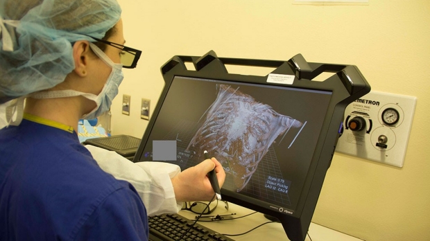 Virtual reality helps surgery