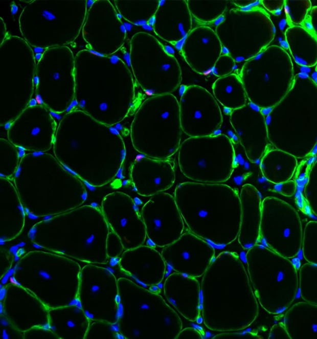 Image of muscle stem cells