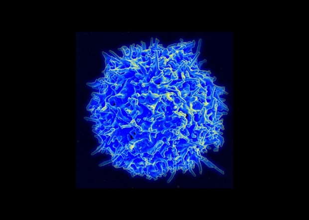 Image of a T cell