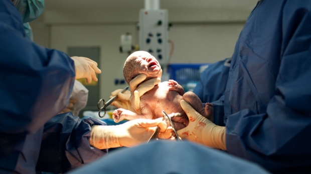 Choice-based C-section pain management