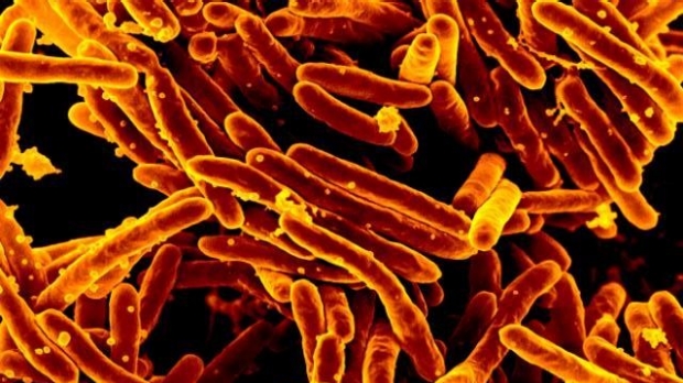 High risk of TB in kids exposed to the disease
