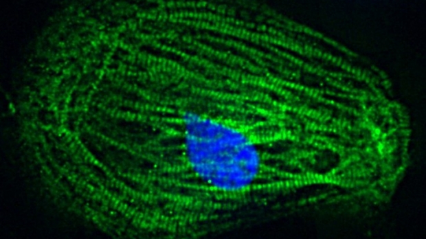 Protecting telomeres improves health of heart muscle cells from people with muscular dystrophy