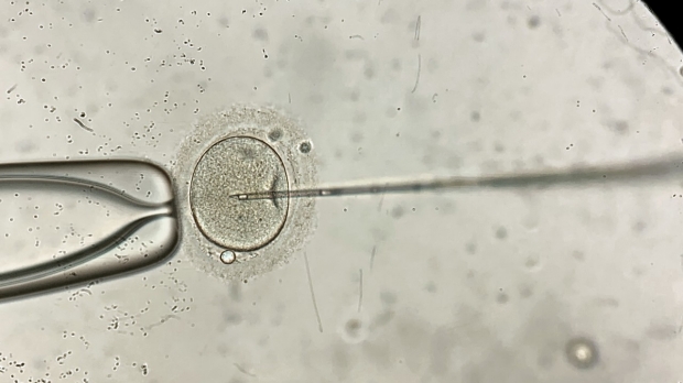 IVF screening reduces costs