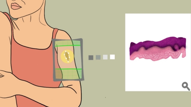 ‘Virtual biopsy’ lets clinicians analyze skin noninvasively