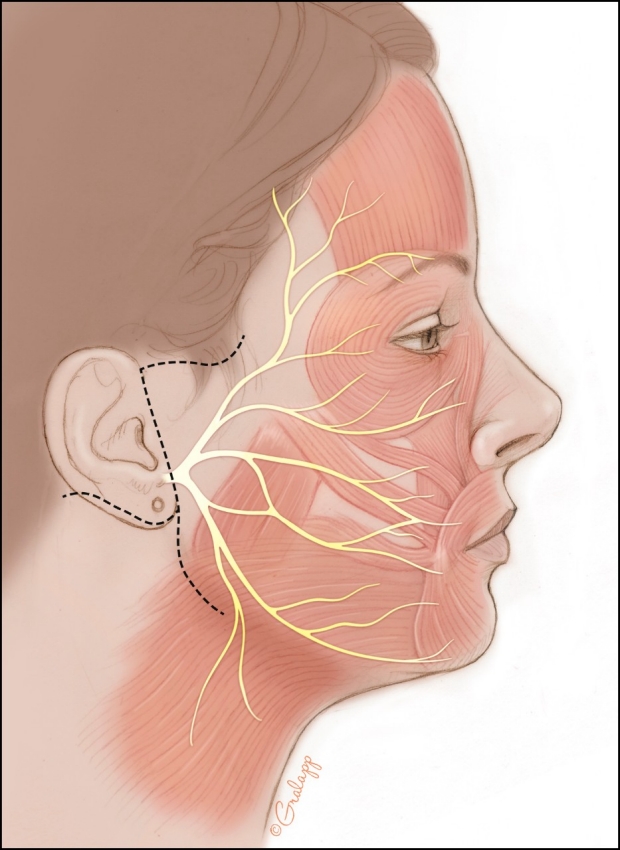 illustration of facial nerves and muscles pc: Chris Gralapp