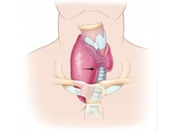 Stanford Endocrine Head and Neck Surgery Program illustration