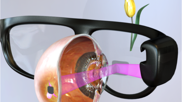 Inventing a new outlook: Restoring sight with electronic photoreceptors and augmented reality glasses