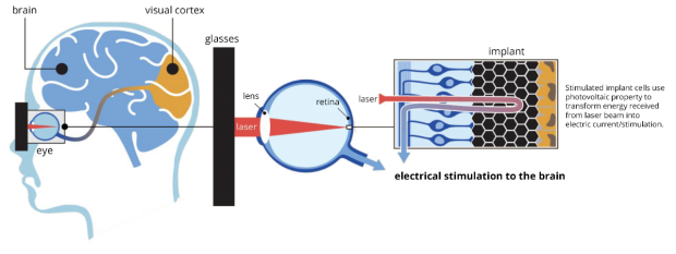 How the PRIMA System signals brain restoration graphic