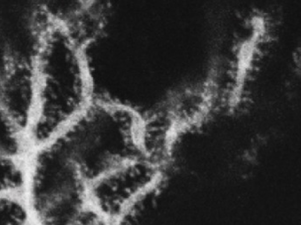 MTSS1 biocytin dendritic connections