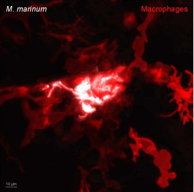 mycobacterium marinum