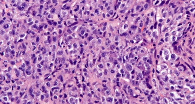 histo photo for Medical Liver subspecialty page for faculty