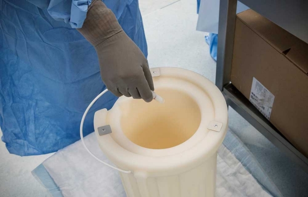 Image of a frozen sample being placed in a container