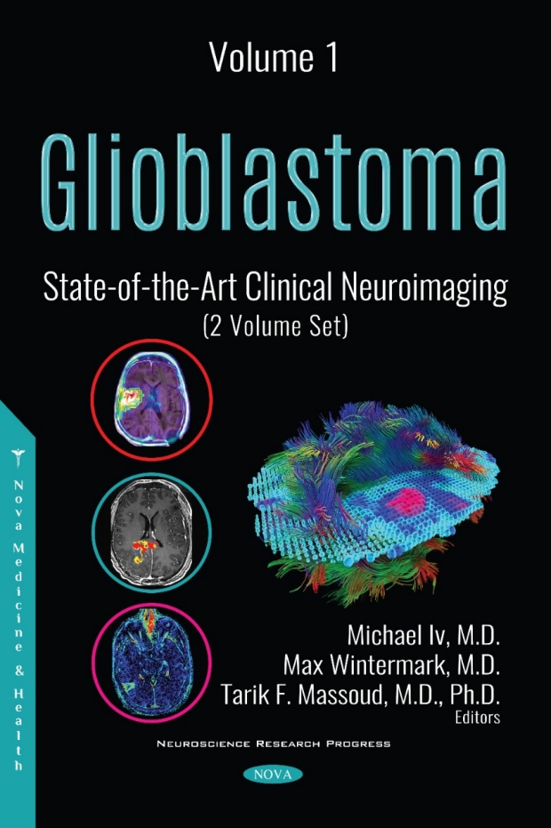 Cover of Glioblastoma: State-of-the-Art Clinical Neuroimaging