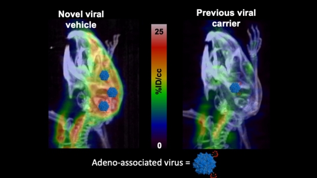 Imaging Therapeutic Adeno-associated Viruses (AAVs)