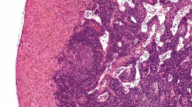 reticker-flynn banner microscope image