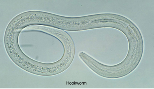 hookworm 