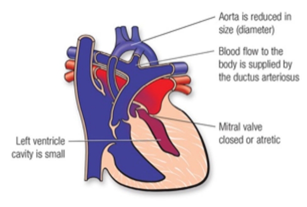 heart graphic