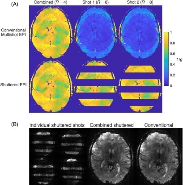 High‐resolution motion‐ and phase‐corrected functional MRI at 7 T using shuttered multishot echo‐planar imaging