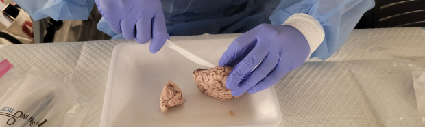 Brain Dissection