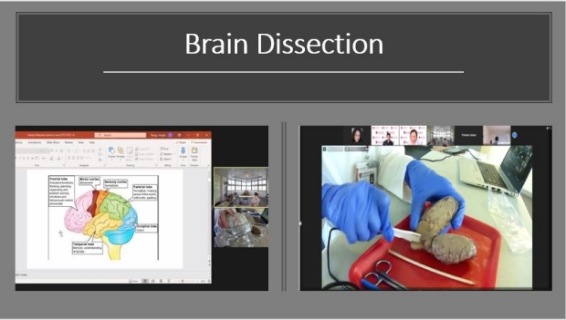 Brain Dissection