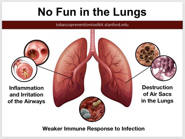 no-fun-in-lungs