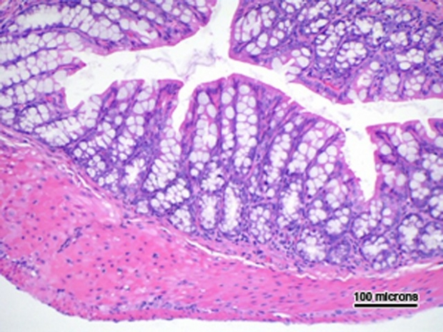 Photomicrograph of large intestines from mouse with acute graft versus host disease (aGVHD)