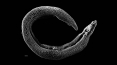 Ramping up treatment of parasitic worm disease cost-effective, researchers find