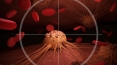 Scientists create ‘guided chemotherapy missiles’ that target cancer cells, spare healthy ones